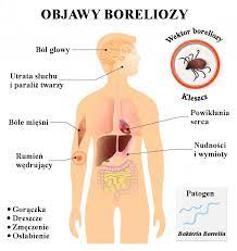 Zaczerwienienie jest całkowicie normalnym objawem. Borrelia Bakteria Ktora Mozesz Pokonac Z Biobalance