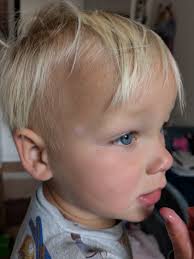 Grandson's boo boo turns into beauty