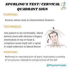 Image result for Spurling Sign