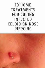 So Entfernen Sie Ein Tattoo Zu Hause Naturlich New 10 Natural Home Reme S Zur Heilung Von Infizierten Keloid Nas Naturliche Hausmittel Nasenpiercing Hausmittel