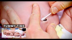 After the umbilical cord stump falls off, baby can sit/lay in the baby bathtub and soak. Umbilical Cord Cleaning Infant Tummy Time Dr Paul Youtube
