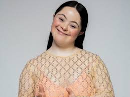 Maybe you would like to learn more about one of these? 18 Year Old Model With Down Syndrome Stars In Gucci Campaign