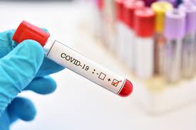 Schnelltests zur einfachen bestimmung von staupe, fiv, felv, borreliose uvm. Corona Tests Wie Wo Und Wer Getestet Wird