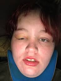 Hello Mommas my name is Angalenna I. Need money to help my feed my family I  got a really bad car accident