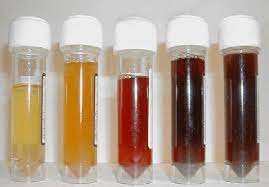 Dit Zegt De Kleur Van Je Urine Over Je Gezondheid Alwareness