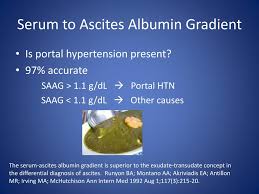 PPT - Evaluation of Ascites PowerPoint Presentation, free download -  ID:946514