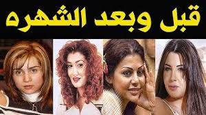 تعد عملية تجميل الأنف rhinoplasty احدى أهم العمليات التجميلية للوجه و ذلك بسبب موقع ما هي الخطوات التي تتم قبل وأثناء وبعد عملية تجميل الأنف ؟ أمور يجب القيام بها بعد يجب عدم استخدام مستحضرات التجميل أو أي كريم غير طبي. Ø²ÙŠÙ† ÙƒØ±Ø²ÙˆÙ† Ù‚Ø¨Ù„ Ø¹Ù…Ù„ÙŠØ§Øª Ø§Ù„ØªØ¬Ù…ÙŠÙ„ Ù…ÙˆØ³ÙŠÙ‚Ù‰ Ù…Ø¬Ø§Ù†ÙŠØ© Mp3