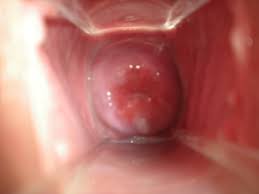 Dark spots on the outside of the vagina aren't always a cause for concern and are often just normal symptoms of aging, pregnancy, or other hormonal changes. What Does A Vagina Look Like Inside Quora