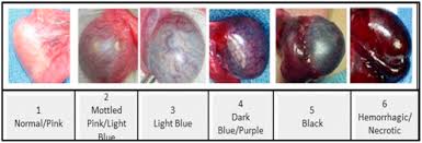 If this works, your doctor will do surgery later to keep the. Prospective Evaluation Of Predictors Of Testis Atrophy After Surgery For Testis Torsion In Children Urology
