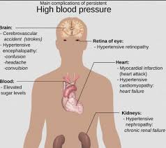 Cerita sedih harini tentang maggi ketam di pcb. Memang Takkan Jadi Bodoh Tapi Doktor Ini Jelas 5 Bahaya Sebenar Makan Mi Segera Remaja