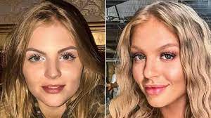 Maybe you would like to learn more about one of these? Acido Hialuronico Tudo Sobre O Ativo Que Conquistou O Mundo Da Beleza Facial Preenchimento Facial Botox Rosto