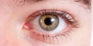 Verletzungen Am Auge