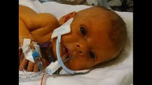 بالصور بعد وفاتها أب يريد تذكر ابنته بصورة دون أنابيب العلاج Addiyar