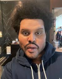 Consisting of 4 prosthetic appliances, main face being a collapsible mold. the post received more. The Weeknd Shows Off Bloated Plastic Surgery Face In Freaky Music Video Mirror Online