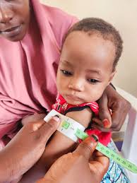 ALBARKA HEALTH SPRING FOUNDATION