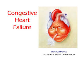 Congestive Heart Failure Muhammad Ali Pediatric Cardiology Division Ppt Download