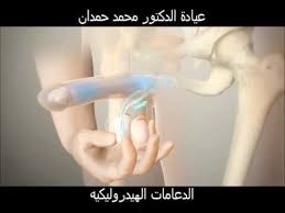 دعامة انتصاب القضيب علاج جراحي لضعف الانتصاب والضعف الجنسي عند الرجال