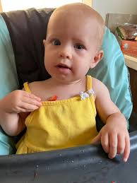 Newborn eye discharge and redness?