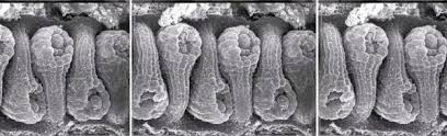 The invention of the electron microscope in the late 1930s and its refinement over the next half century permitted vastly improved visualization of cell and tissue fine structure. Wt Ovule Sem 5 Fischer Lab