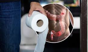 Image result for thin ribbon stools human poop