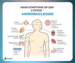 Epstein Barr Virus Symptoms Causes 10 Ways To Fight Epstein Barr Virus Naturally And Epstein Barr Diet 24 Healing Foods Ecosh Life