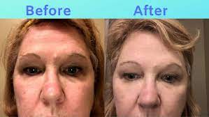 Read honest and unbiased product reviews from our users. Do Sio Beauty Patches Remove Wrinkles Reviewed