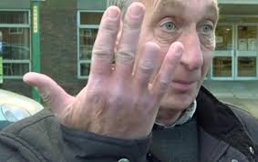 Postman has FINGER torn off by a Staffie as he pushes letter through door