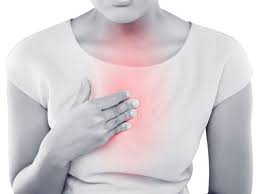 Chest pain is pain or discomfort in the chest, typically the front of the chest. Chest Pain Is It Heartburn Or A Heart Condition Rennie