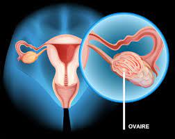 Glande génitale femelle, paire, symétrique, située de part et d'autre de ovaire blog, elle était facile mais pourtant personne ne l'avait jamais faite. Mal Aux Ovaires Regles Ovulation Rapport Quelle Cause