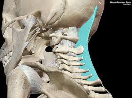 The ligamentum nuchae are very strong. Nuchal Ligament Between Occipital Bone And C7 Of Cervical Vertebrae Cervical Spinal Stenosis Cervical Cervical Vertebrae