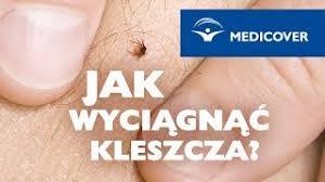 Borelioza jest stosunkowo nową chorobą, ponieważ pierwsze rozpoznania jej datuje się na okres drugiej połowy lat 80 xx wieku. Borelioza Objawy Boreliozy