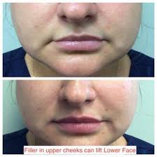 Orchard Park Dermatology, 3045 Southwestern Blvd, Ste 104, Orchard Park, NY  14127, US