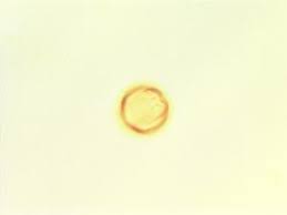 Image result for Melastomastrum segregatum