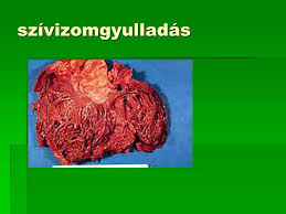 Vírusok, baktériumok, toxinok is okozhatják. A Sziv Betegsegei Ppt Letolteni