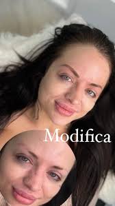 Does anyone know of a good dog acupuncturist? I have a dachshund with IVDD  and they recommended accupuncture for it