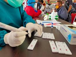 Hore Kimia Farma Jual Rapid Test Di Bawah Rp100 Ribu Mulai Agustus