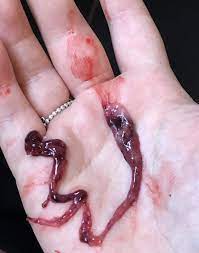 We did not find results for: Misscarriage Warning Graphic Photos