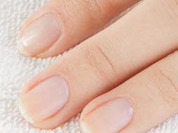 Nail Abnormalities Causes Symptoms And Pictures