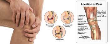 Pin On Health Meniscus Injury Sprained Knee
