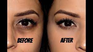 Chantelle baker has shared her secrets for how to correctly apply. Conceal Dark Circles No Creasing Youtube