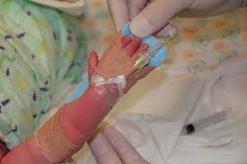 Image result for Peripheral IV Access