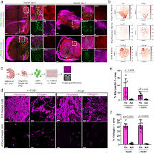 Wound infiltrating adipocytes are not myofibroblasts
