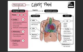 Some associated symptoms can include dizziness, sensation of shortness of breath. Dx Schema Chest Pain The Clinical Problem Solvers