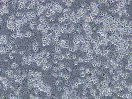 Some are grouches while others are chatterboxes. Can Anyone Provide Information On How To Maintain My Animal Cell Culture