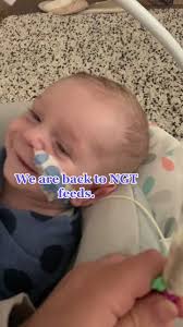 Lunch time!⭐️ #nasogastrictube #lunchtime #babyboy #chd #chdawareness #yum  #newmumma #newborn #fyp