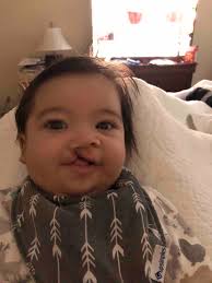 Fundraiser by Sarah Colon : Bens forever smile