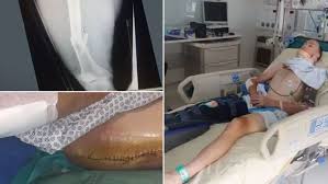 Froome was initially assessed at roanne hospital before being airlifted to st. Ciclismo Chris Froome Mi Unico Objetivo Es Volver Al Tour De Francia El Ano Que Viene Marca Com