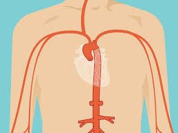 Many have no symptoms and are not dangerous. Aneurysm Causes Symptoms And Diagnosis