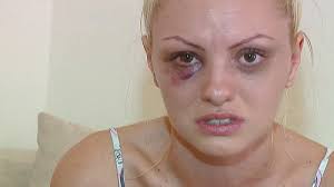 221 tracks | 60 albums. Sangerin Alexandra Stan Vom Freund Verprugelt