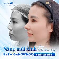 Phẫu Thuật Nâng Mũi Nội Soi 4K Vi Phẫu: Ưu Điểm Và Chi Phí